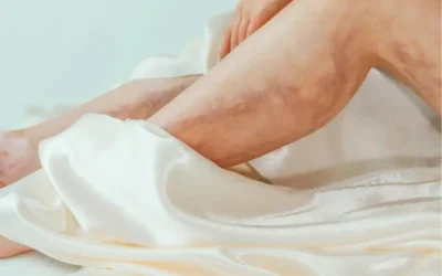 Piernas pesadas en verano: no es cansancio sino circulación.