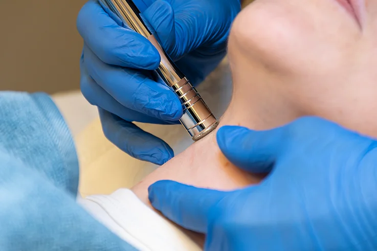 Tratamiento reafirmante de cuello con aparatología estética facial